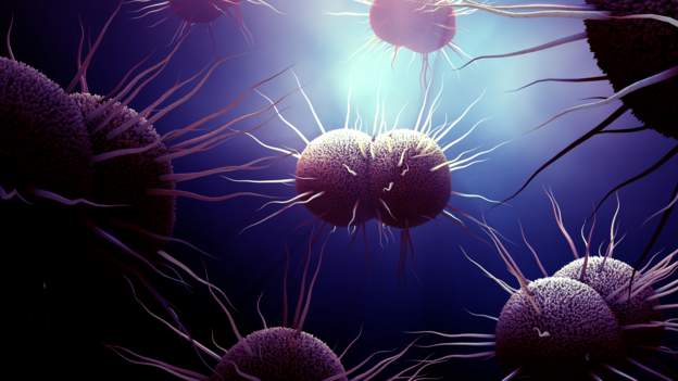 New gonorrhoea strain detected in Nairobi The gonorrhoea bacteria is spread through unprotected sex