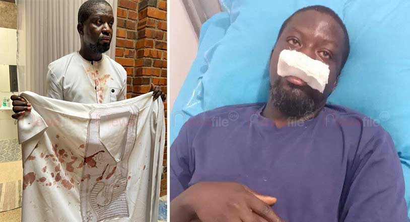 Police investigate alleged assault on Ibrahim Mahama